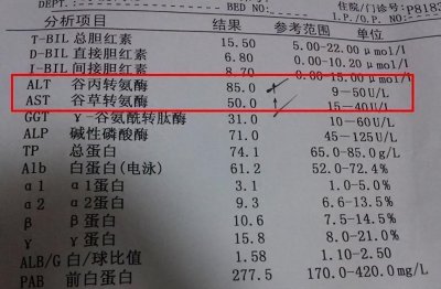 ​体检报告转氨酶升高有何意义 体检报告转氨酶偏高是什么原因?