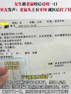 ​炸裂，18岁女孩被老鼠咬了手一气之下一口咬到老鼠头留下两个牙印