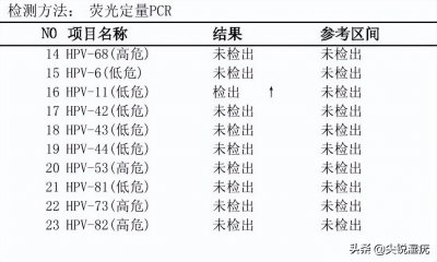 ​女性hpv真实图片